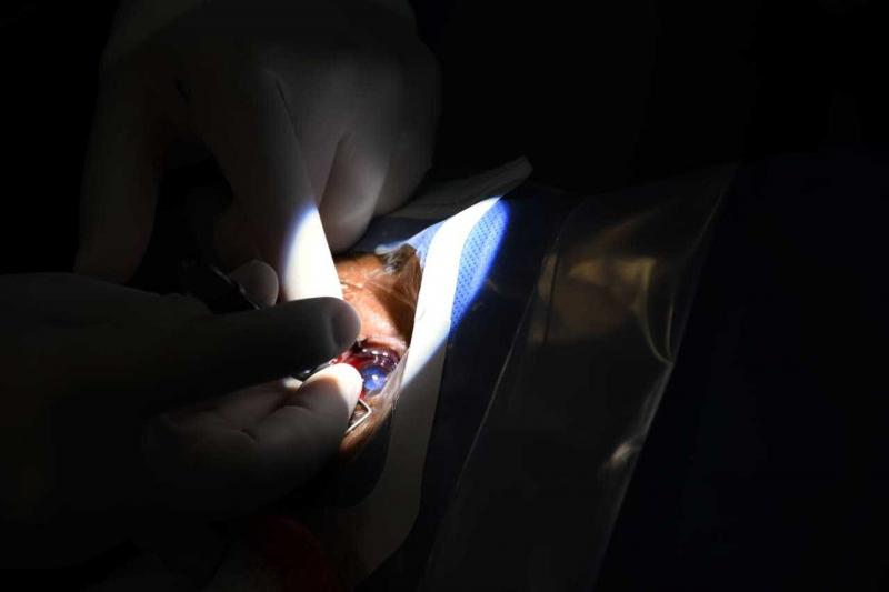 Realizan jornadas de cirugías gratuitas de cataratas